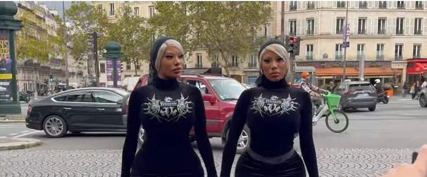 Clermont Twins Before Surgery