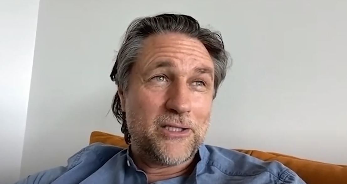 Martin Henderson Plastic Surgery