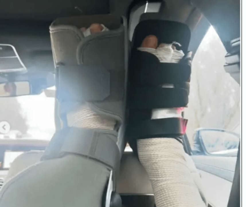 Lara Spencer Feet Surgery